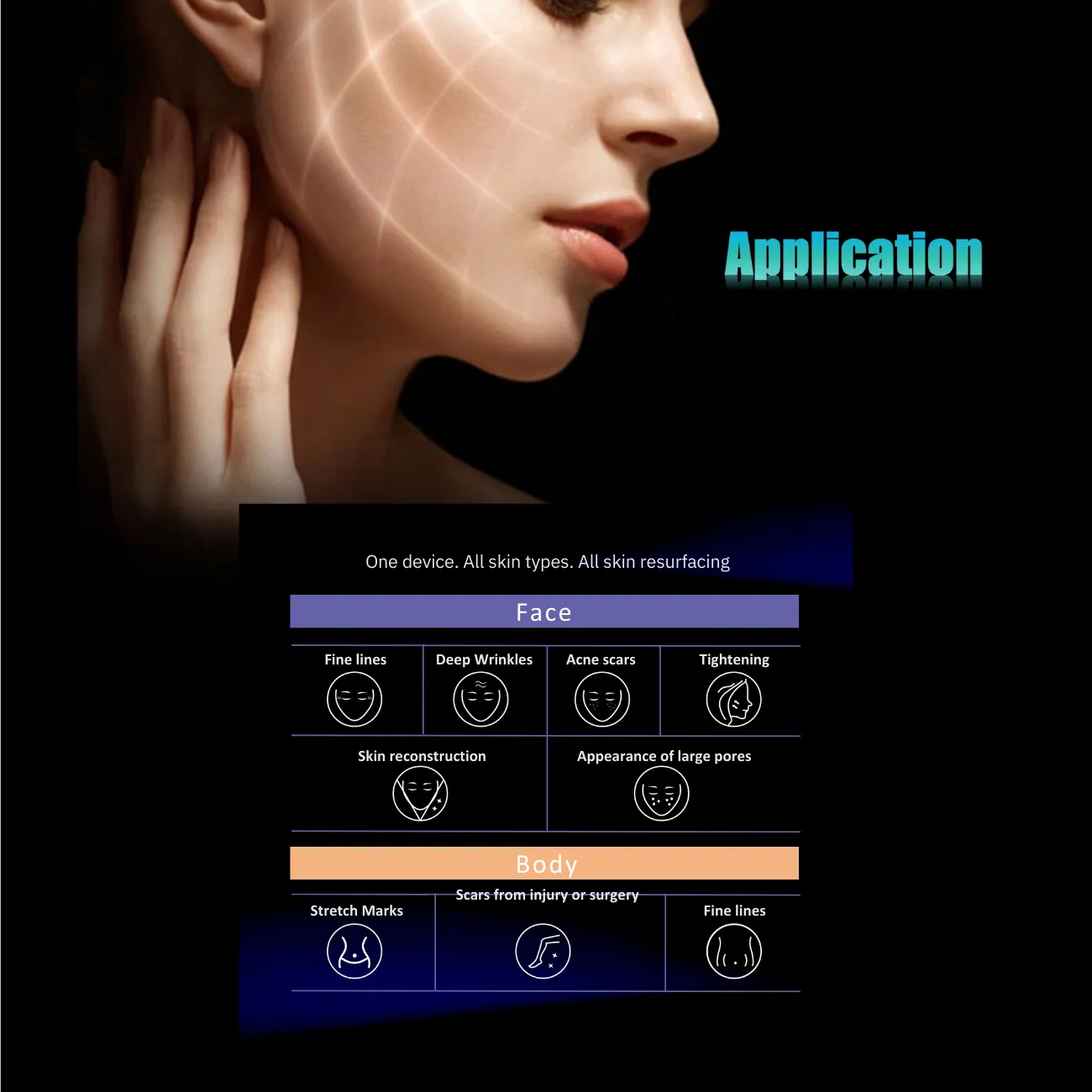 Proteus-V RF Micro-needle   Thermagica Fractional RF System