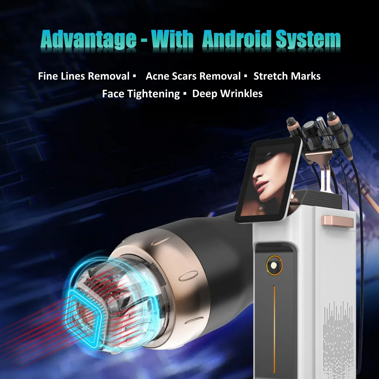 Proteus-V RF Micro-needle   Thermagica Fractional RF System